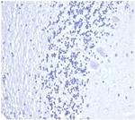 Prostate Specific Antigen (PSA) Antibody in Immunohistochemistry (Paraffin) (IHC (P))