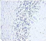 Prostate Specific Antigen (PSA) Antibody in Immunohistochemistry (Paraffin) (IHC (P))