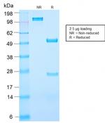 Prostate Specific Antigen (PSA) Antibody in SDS-PAGE (SDS-PAGE)