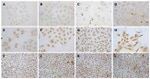 MUC4 Antibody in Immunohistochemistry (IHC)