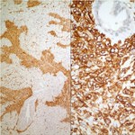 MUC4 Antibody in Immunohistochemistry (IHC)