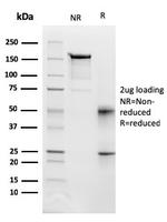 CD95/FAS/TNFRSF6 Antibody in SDS-PAGE (SDS-PAGE)