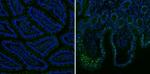 Mouse IgG (H+L) Secondary Antibody in Immunohistochemistry (Paraffin) (IHC (P))