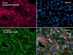 Mouse IgG (H+L) Secondary Antibody in Immunocytochemistry (ICC/IF)