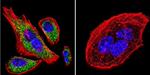 Mouse IgG (H+L) Cross-Adsorbed Secondary Antibody in Immunocytochemistry (ICC/IF)