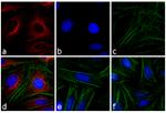 Mouse IgG (H+L) Cross-Adsorbed Secondary Antibody in Immunocytochemistry (ICC/IF)