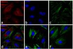 Mouse IgG (H+L) Secondary Antibody in Immunocytochemistry (ICC/IF)