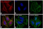 Mouse IgG (H+L) Secondary Antibody in Immunocytochemistry (ICC/IF)