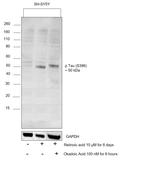 Phospho-Tau (Ser396) Antibody in Western Blot (WB)