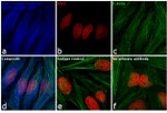 Rabbit IgG (H+L) Secondary Antibody in Immunocytochemistry (ICC/IF)