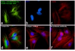 Rabbit IgG (H+L) Secondary Antibody in Immunocytochemistry (ICC/IF)