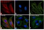 Rabbit IgG (H+L) Secondary Antibody in Immunocytochemistry (ICC/IF)