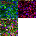 Rabbit IgG (H+L) Secondary Antibody in Immunocytochemistry (ICC/IF)