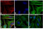 Rabbit IgG (H+L) Secondary Antibody in Immunocytochemistry (ICC/IF)