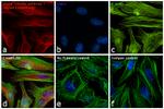 Rabbit IgG (H+L) Secondary Antibody in Immunocytochemistry (ICC/IF)