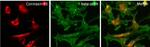 Rabbit IgG (H+L) Secondary Antibody in Immunocytochemistry (ICC/IF)