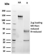 Fas Ligand (FASLG) Antibody in SDS-PAGE (SDS-PAGE)