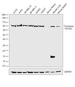 Tyrosinase Antibody