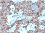 Interleukin-3 (IL-3) Antibody in Immunohistochemistry (Paraffin) (IHC (P))