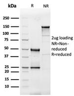 Interleukin-3 (IL-3) Antibody in SDS-PAGE (SDS-PAGE)
