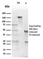 Interleukin-5 (IL-5) Antibody in SDS-PAGE (SDS-PAGE)