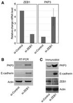 PKP3 Antibody in Western Blot, ChIP Assay (WB, ChIP)