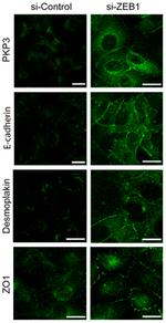 PKP3 Antibody in Immunocytochemistry (ICC/IF)