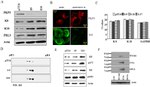 PKP3 Antibody in Western Blot, Immunocytochemistry (WB, ICC/IF)