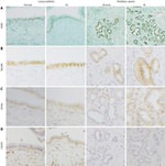 CXCR4 Antibody in Immunohistochemistry (IHC)