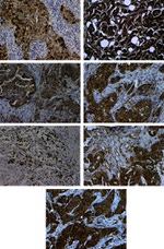 CXCR4 Antibody in Immunohistochemistry (IHC)