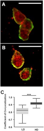 Prolactin Receptor Antibody in Immunocytochemistry (ICC/IF)