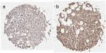 Prolactin Receptor Antibody in Immunohistochemistry (IHC)