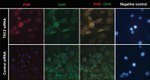 Prolactin Receptor Antibody in Immunocytochemistry (ICC/IF)