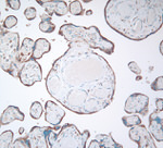 GRP94 Antibody in Immunohistochemistry (IHC)