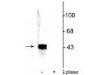 Phospho-ERK1/ERK2 (Thr202, Tyr204) Antibody in Western Blot (WB)