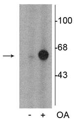 Phospho-Tyrosine Hydroxylase (Ser31) Antibody in Western Blot (WB)