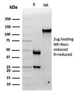 Interleukin-15 (IL-15) Antibody in SDS-PAGE (SDS-PAGE)