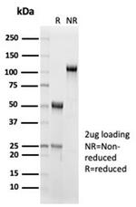 Interleukin-15 (IL-15) Antibody in SDS-PAGE (SDS-PAGE)