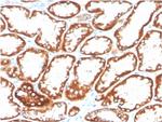 CD137/4-1BB/TNFRSF9 Antibody in Immunohistochemistry (Paraffin) (IHC (P))