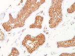 Inhibin, alpha (INHA) (Gonadal Cell Marker) Antibody in Immunohistochemistry (Paraffin) (IHC (P))