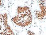 Inhibin, alpha (INHA) (Gonadal Cell Marker) Antibody in Immunohistochemistry (Paraffin) (IHC (P))