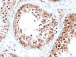 Inhibin, alpha (INHA) Antibody in Immunohistochemistry (Paraffin) (IHC (P))