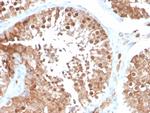 Inhibin, alpha (INHA) Antibody in Immunohistochemistry (Paraffin) (IHC (P))