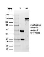 Inhibin, alpha (INHA) Antibody in SDS-PAGE (SDS-PAGE)