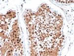 Inhibin, alpha (INHA) (Gonadal Cell Marker) Antibody in Immunohistochemistry (Paraffin) (IHC (P))