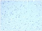 Inhibin, alpha (INHA) (Gonadal Cell Marker) Antibody in Immunohistochemistry (Paraffin) (IHC (P))