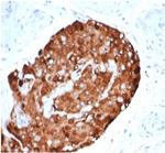 Inhibin, alpha (INHA) (Gonadal Cell Marker) Antibody in Immunohistochemistry (Paraffin) (IHC (P))