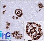 Insulin (beta-Cell and Insulinoma Marker) Antibody in Immunohistochemistry (Paraffin) (IHC (P))