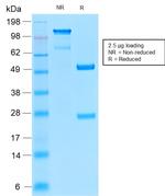 Insulin Receptor Alpha Antibody in SDS-PAGE (SDS-PAGE)