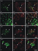 Connexin 36 Antibody in Immunocytochemistry (ICC/IF)